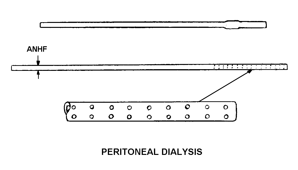 PERITONEAL DIALYSIS style nsn 6515-01-345-5171