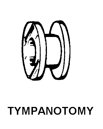 TYMPANOTOMY style nsn 6515-01-379-9759