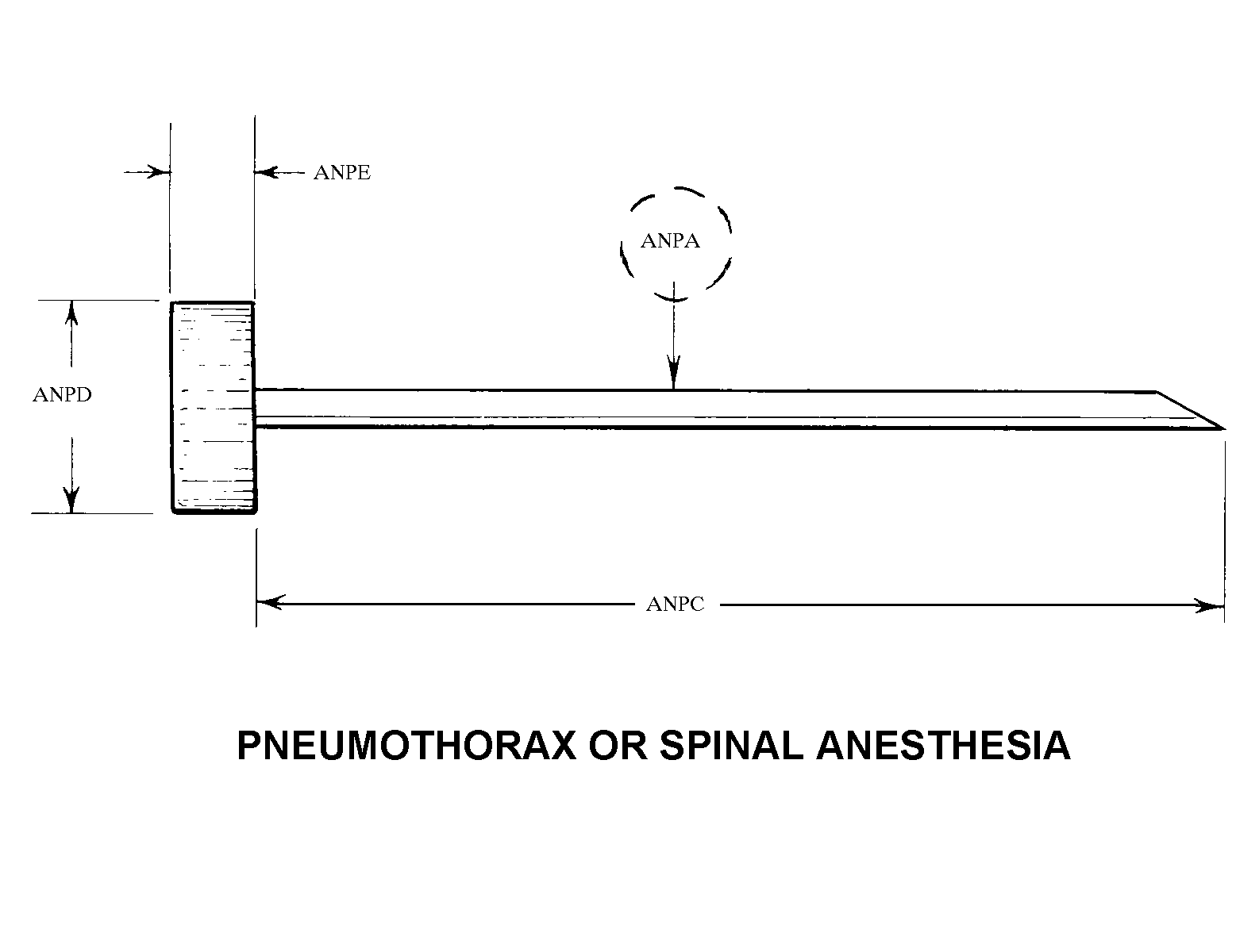 PNEUMOTHORAX OR SPINAL ANESTHESIA style nsn 6515-01-528-0740