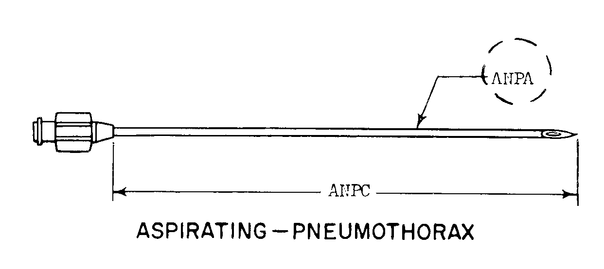 ASPIRATING-PNEUMOTHORAX style nsn 6515-01-236-6420