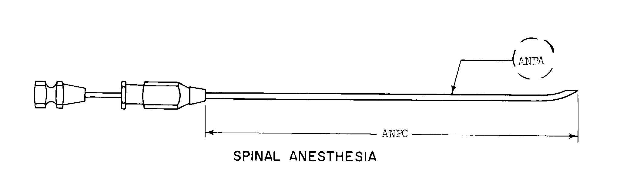 SPINAL ANESTHESIA style nsn 6515-01-344-1122