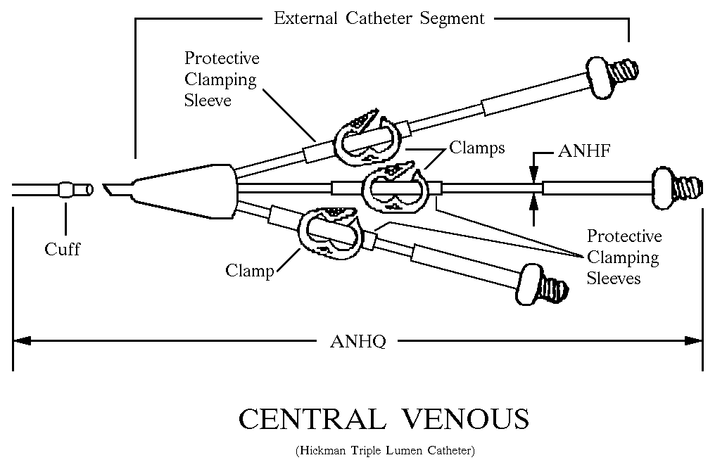 CENTRAL VENOUS style nsn 6515-01-470-8515