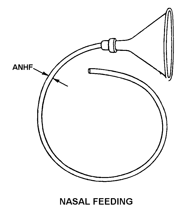 NASAL FEEDING style nsn 6515-01-228-1966